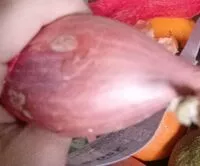 Zuckermenge drin Schalotten